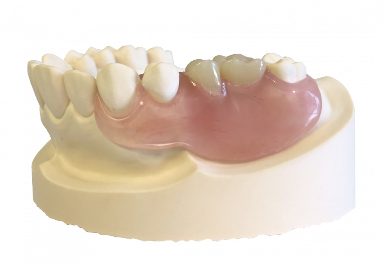 ノンクラスプデンチャーの研磨に困ったら…