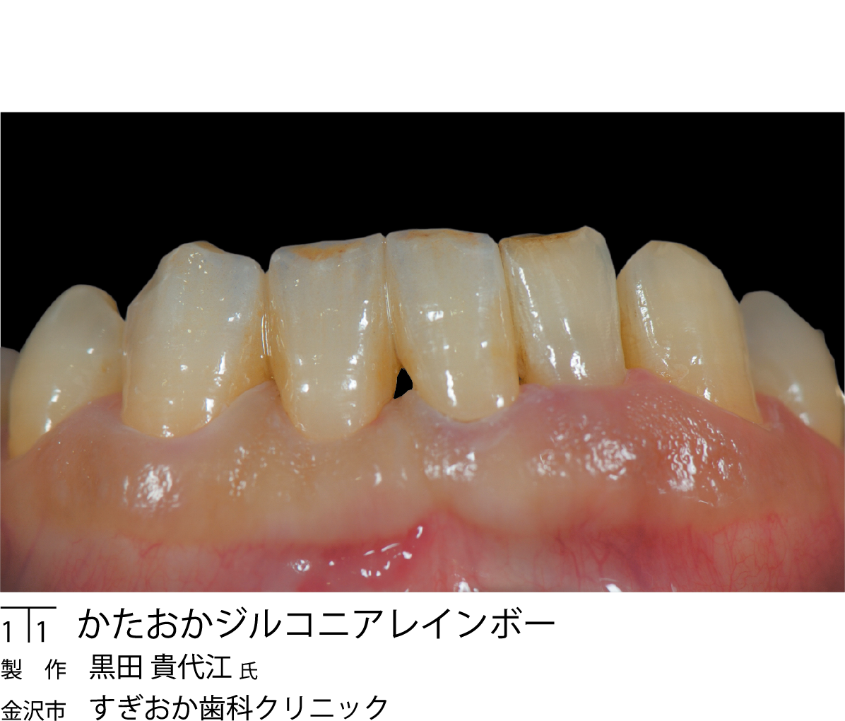 <CAD/CAM用ジルコニアディスク>かたおかデンタルジルコニア